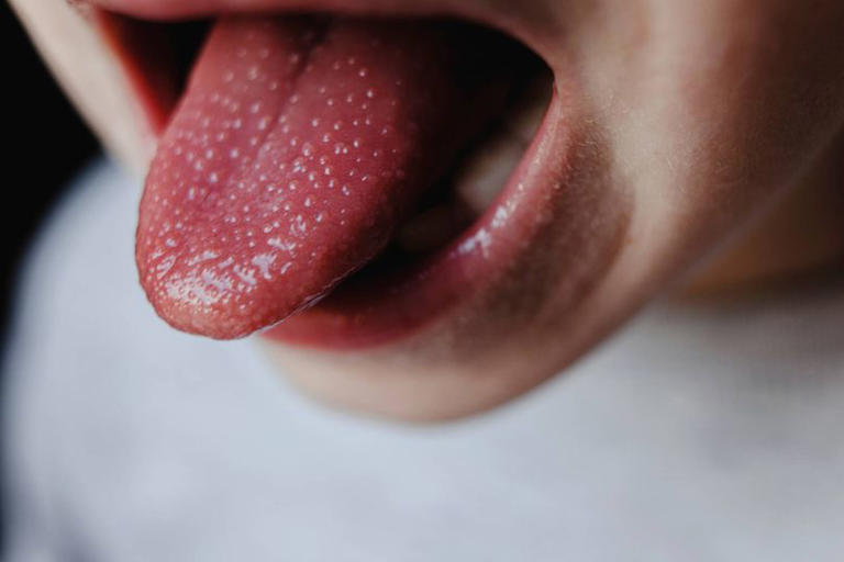 New 'Victorian' infection warning signs as pharmacist says 'it can be ...