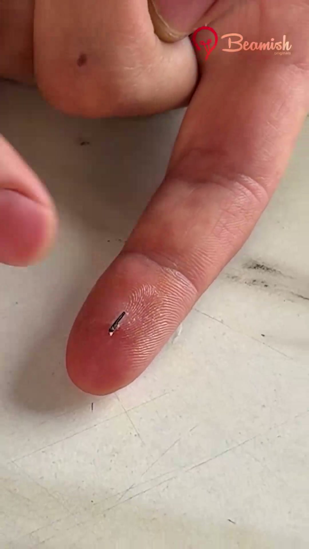 Practical foot care and splinter removal hacks #diy #foot #caretips