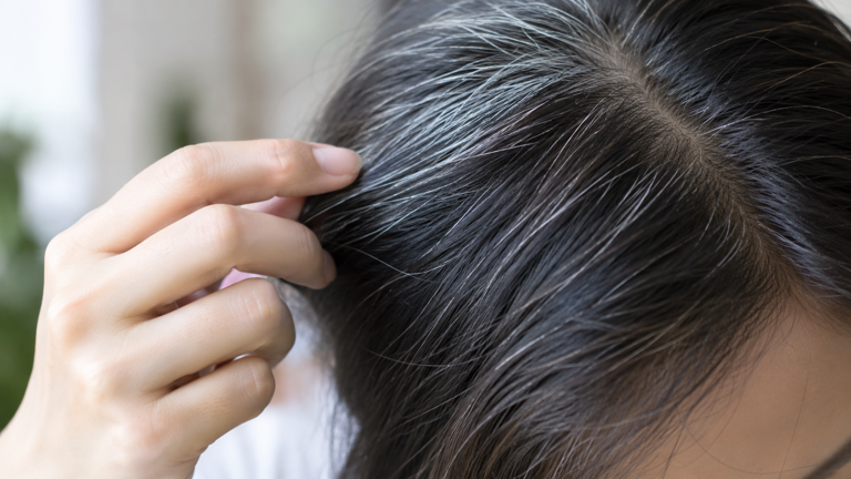 Tóc bạc có liên quan đến yếu tố di truyền. Ảnh được tạo bởi AI