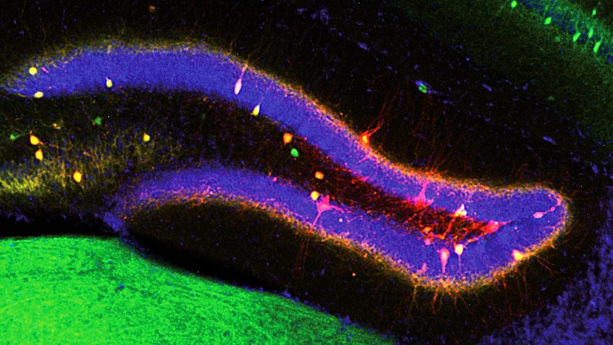 Researchers discover how the brain updates memories with new information