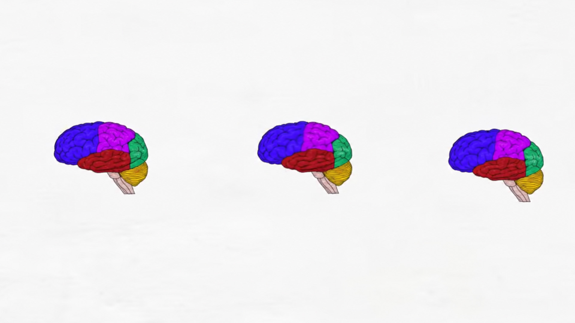 A simple guide to brain surface anatomy