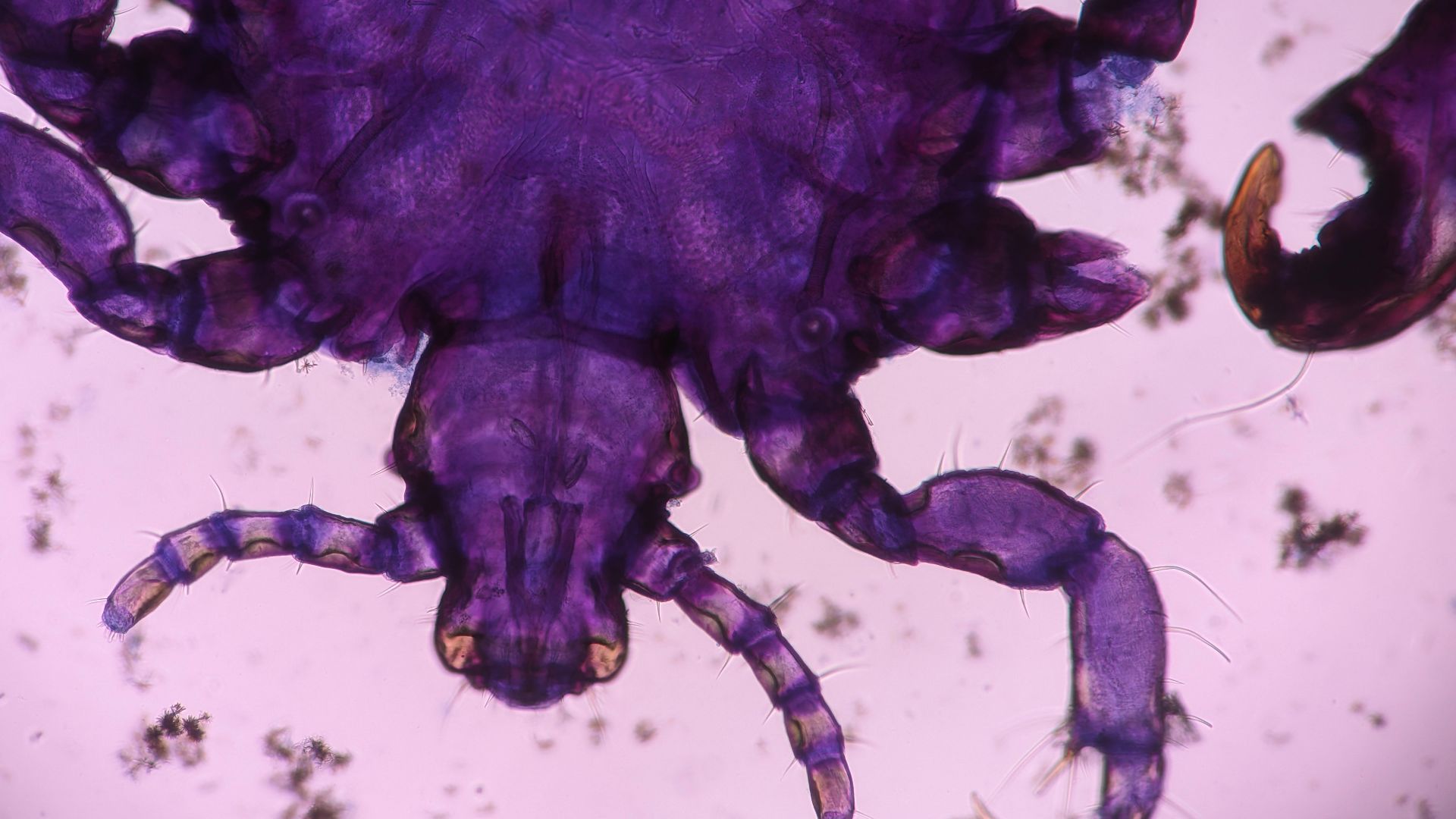 Battle of the body: Foods that fight parasites
