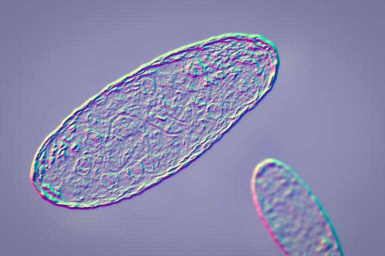 Russia’s reported plague death secrecy could be related to 'bioweapons ...