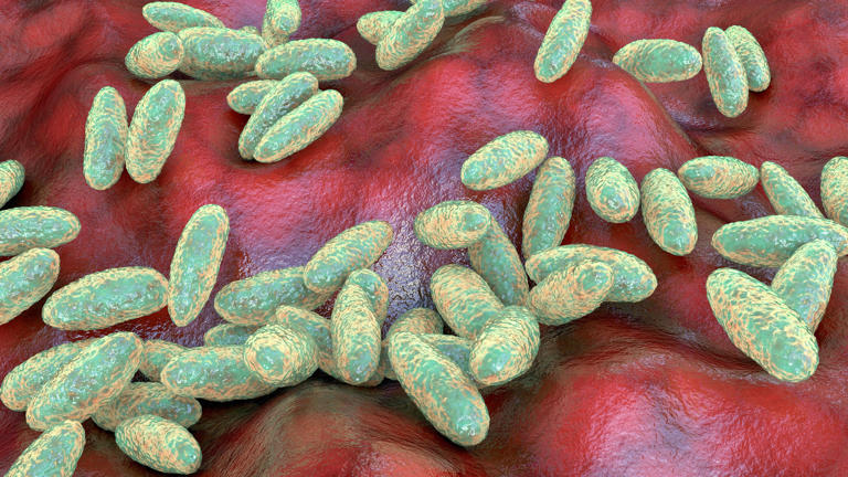 US monitoring suspected fatal pneumonic plague case in Russia, State ...