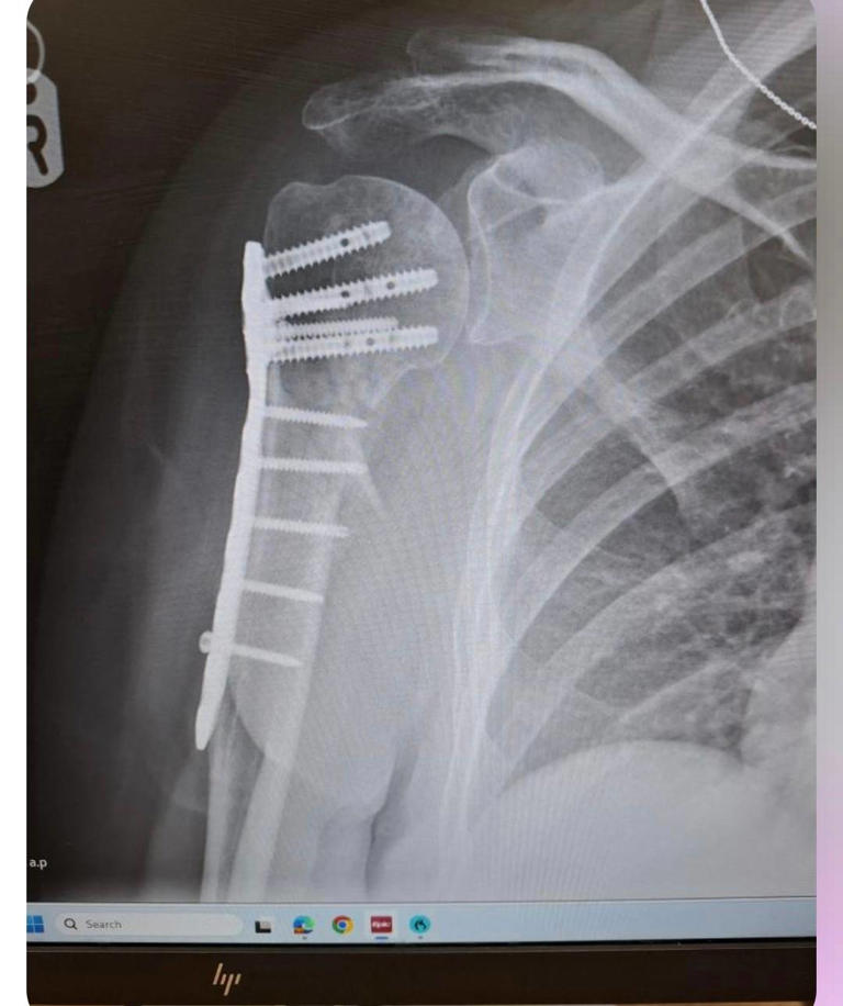 Woman’s ‘living nightmare’ after being dragged out to sea by horror ...