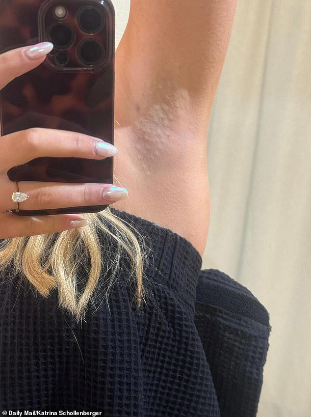 Biggest bridal beauty myths busted and the painful cosmetic procedures ...