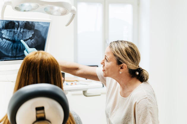 Do redheads need more anesthesia? The answer is complicated.