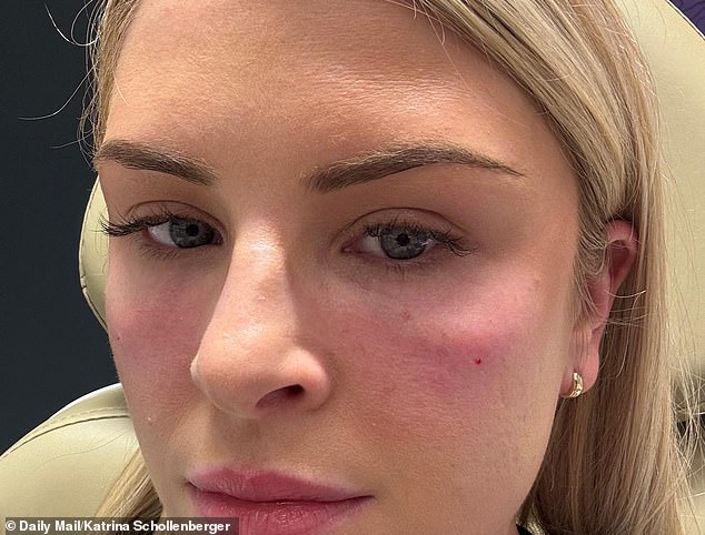 Biggest bridal beauty myths busted and the painful cosmetic procedures ...