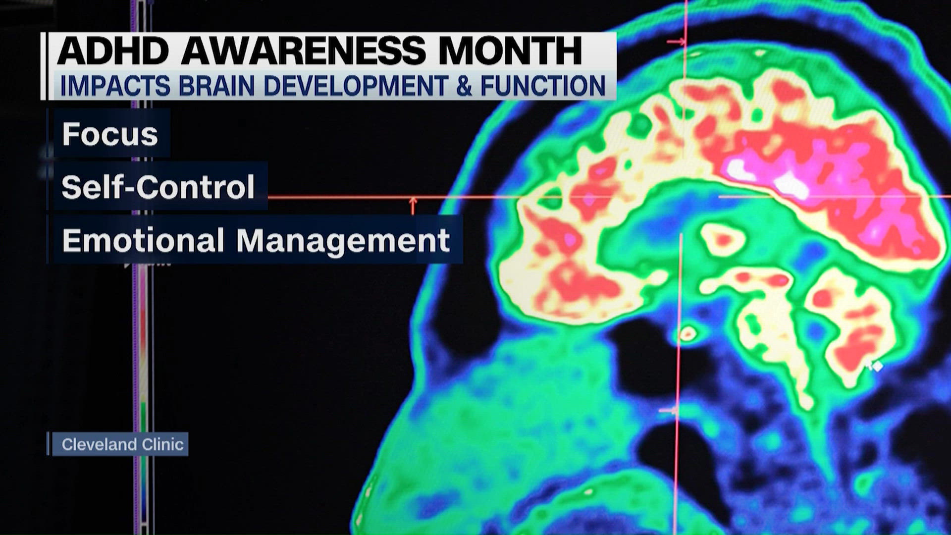 Signs of ADHD in women | ADHD Awareness Month
