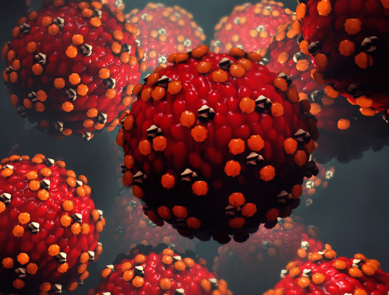 Possible measles exposure at Trudeau Airport, Ste-Justine Hospital ...