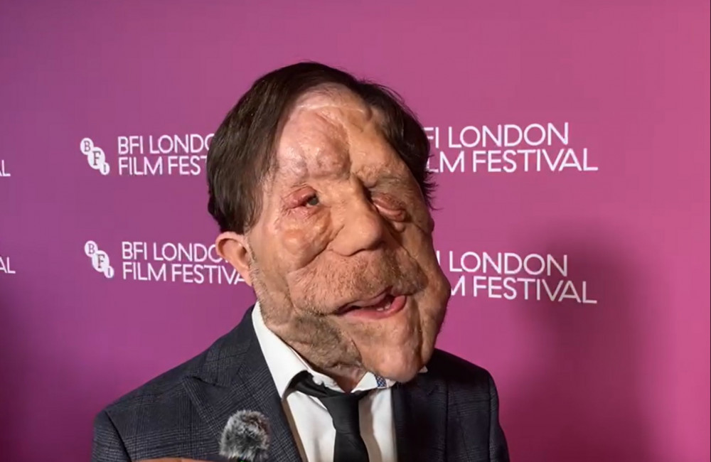 Adam Pearson would love to work with Adam Sandler