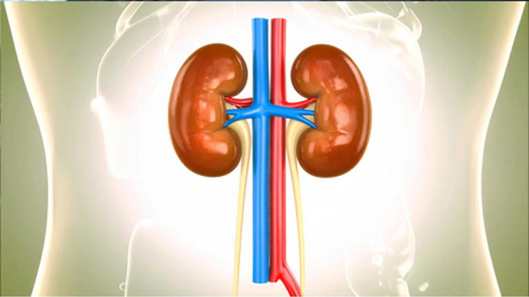 Kidney stones: how they form, and do men and women get them differently?