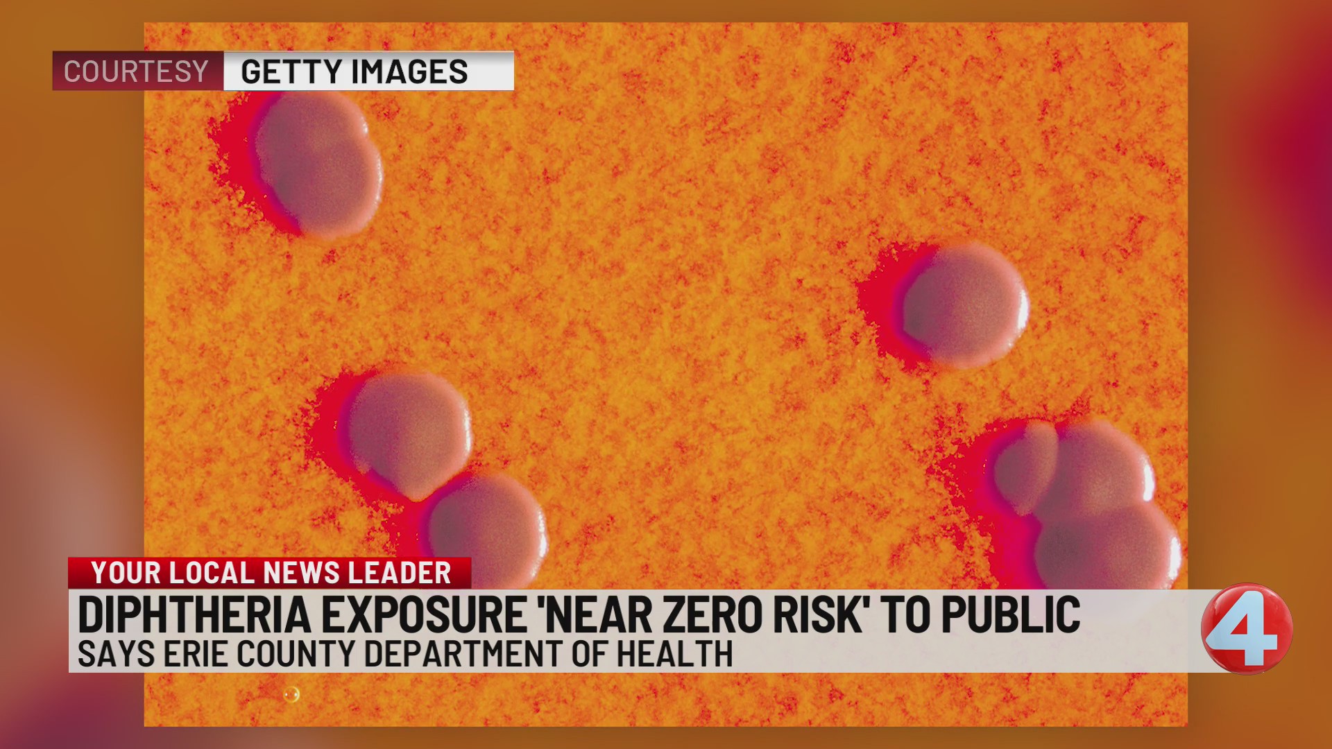 Diphtheria exposure 'near zero risk' to public