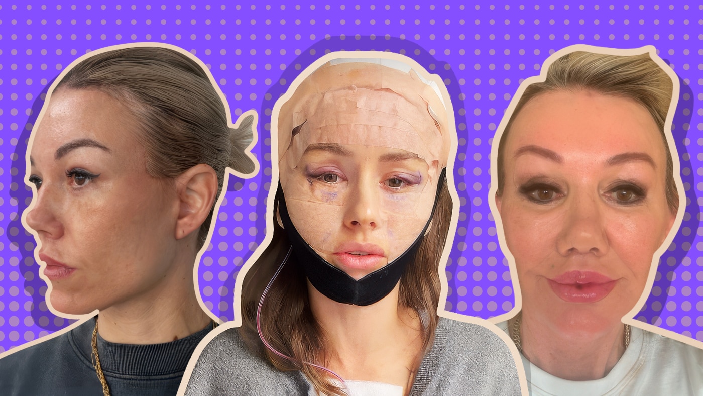 South Korean company cancels cosmetic surgery event after ABC raises ...
