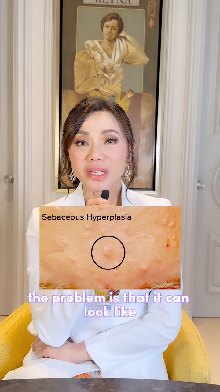Seeing tiny bumps on your face, darlings? Don't panic just yet!