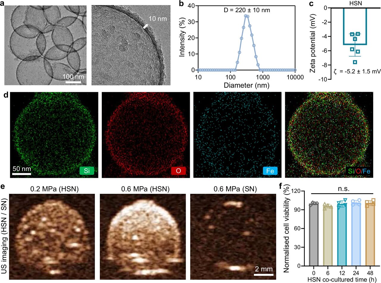 Nanostructure-assisted ultrasound shows potential for Parkinson's treatment