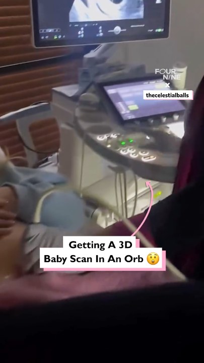 3D baby scan in an orb
