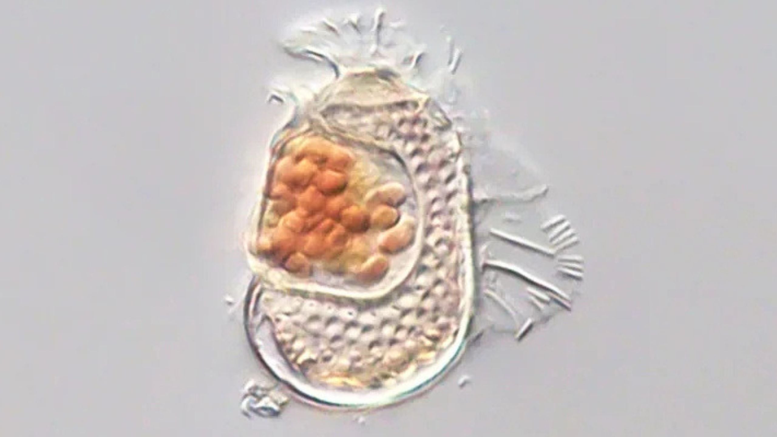 Microbe discovered with one of the smallest genomes on record, pushing ...