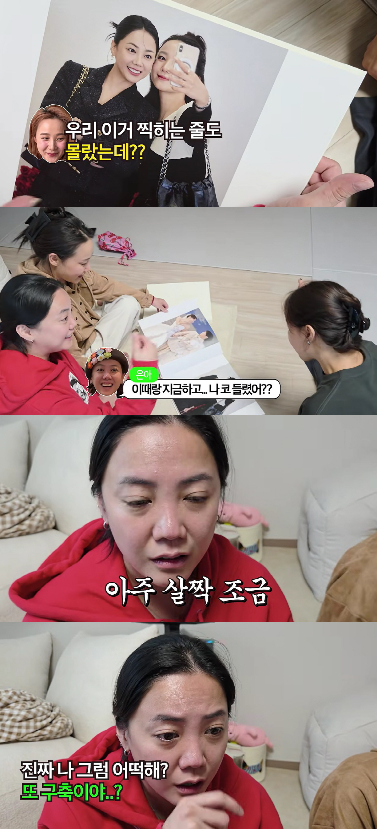 Go Eun-ah spent the price of a car on revision rhinoplasty—but three ...