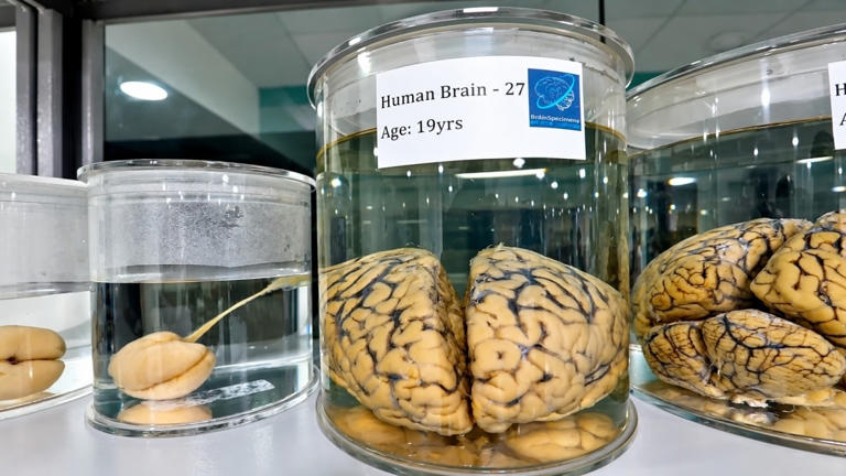 IIT-Madras wants to zoom deep inside human brain. PM tasks them to ...