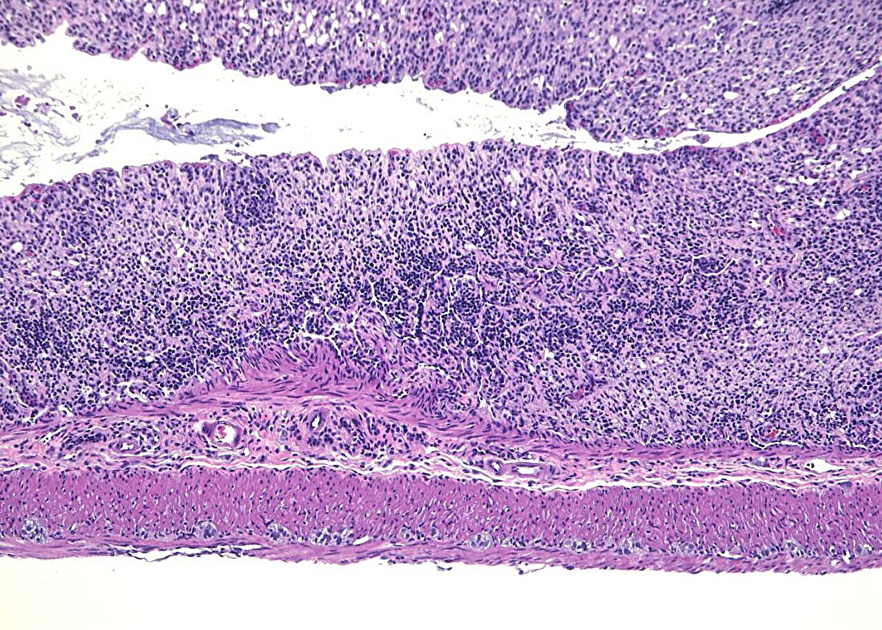 Protein reins in intestinal inflammation by curbing an overactive ...