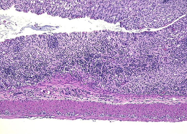 Protein reins in intestinal inflammation by curbing an overactive ...