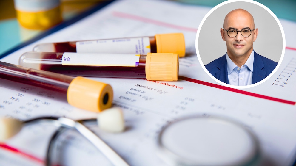 These blood values reveal dangers long before a diagnosis