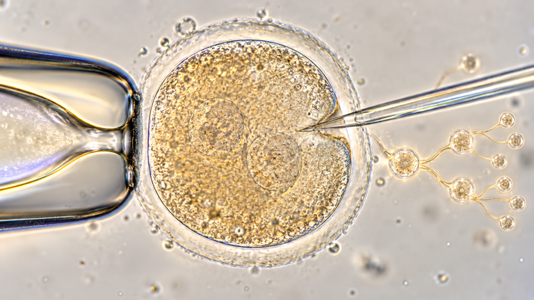 Scientists construct a 'family tree' containing 1.28 million cells from ...