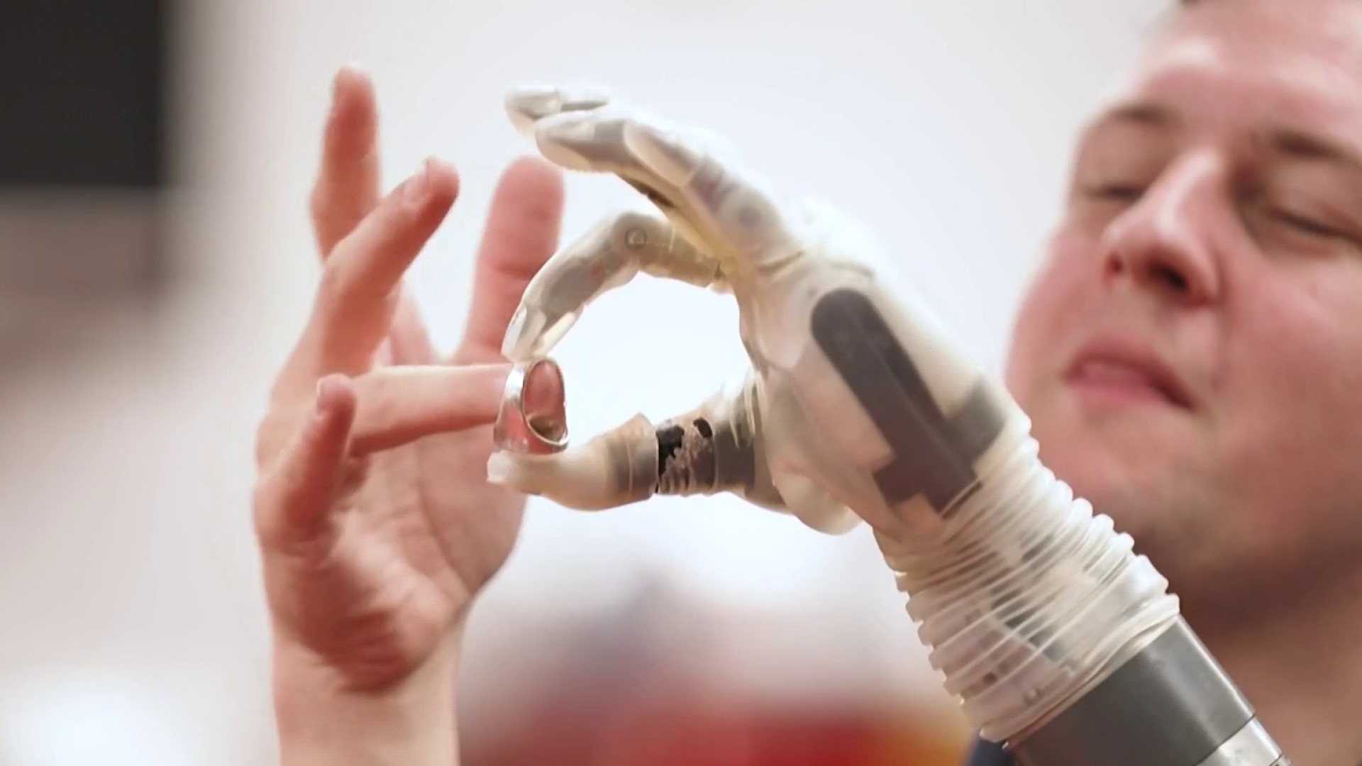 An AI-powered chip allows an amputee to control his robot prosthetic ...