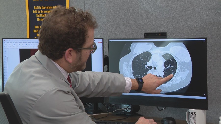 Pope Leo has lung cancer. Local doctor explains diagnosis and next steps