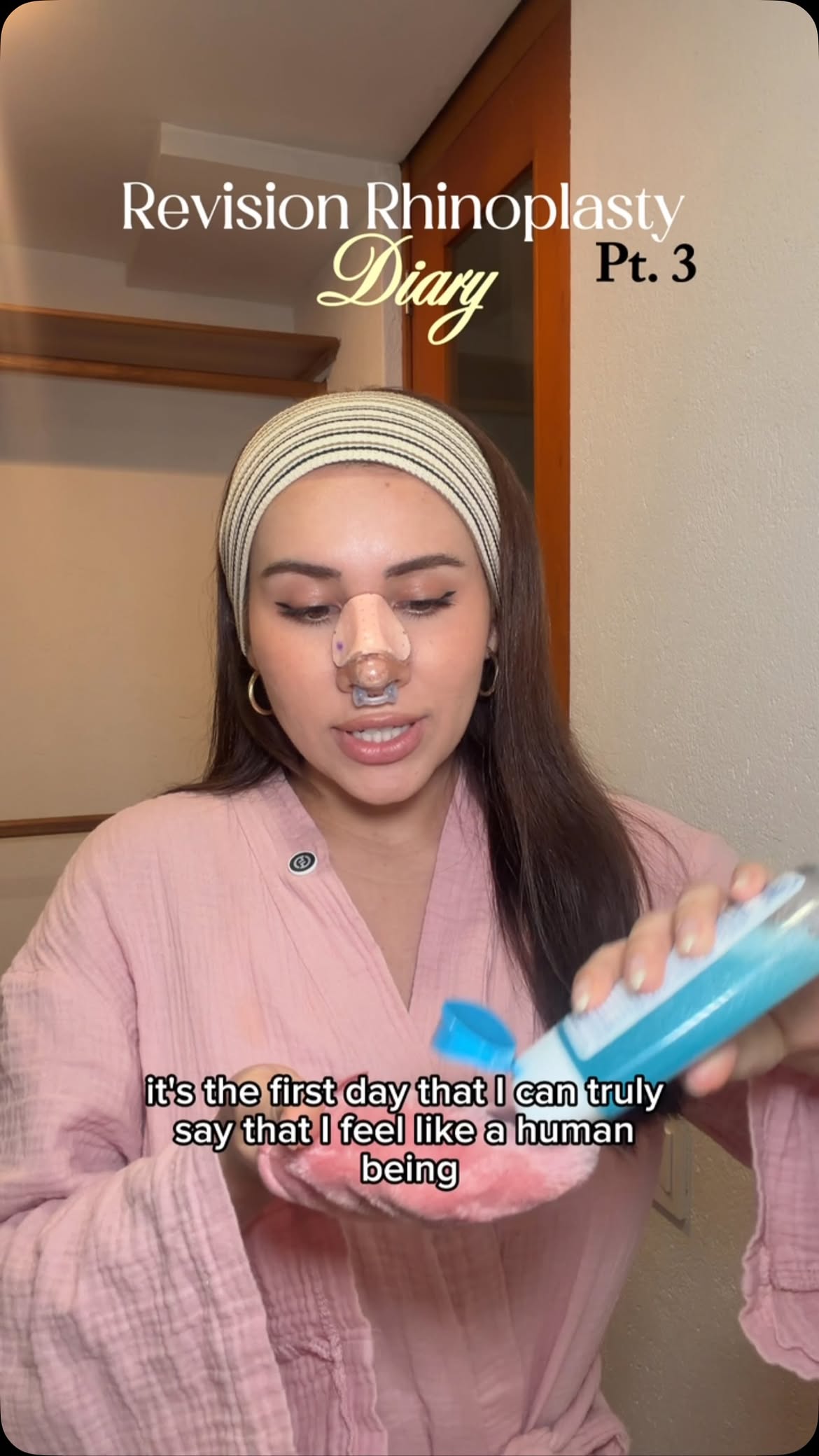 6 days after revision rhinoplasty