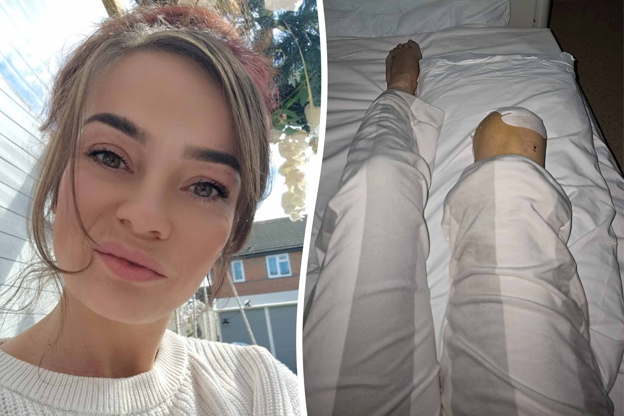 Mum had leg amputated after doctors misdiagnosed rare vascular disease ...