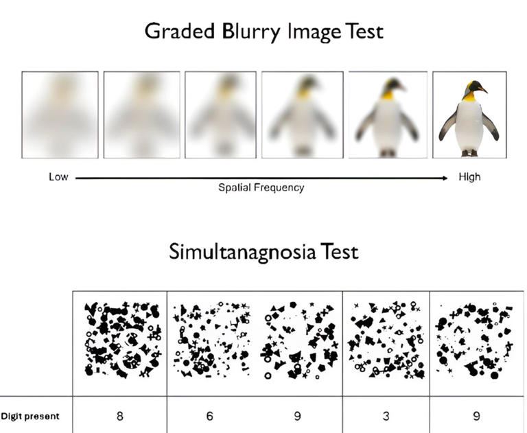 Visual processing tests could help diagnose some common forms of dementia