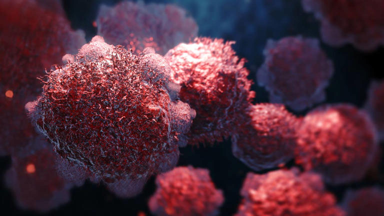 Scientists linked 12 infections to cancer, and some are extremely common