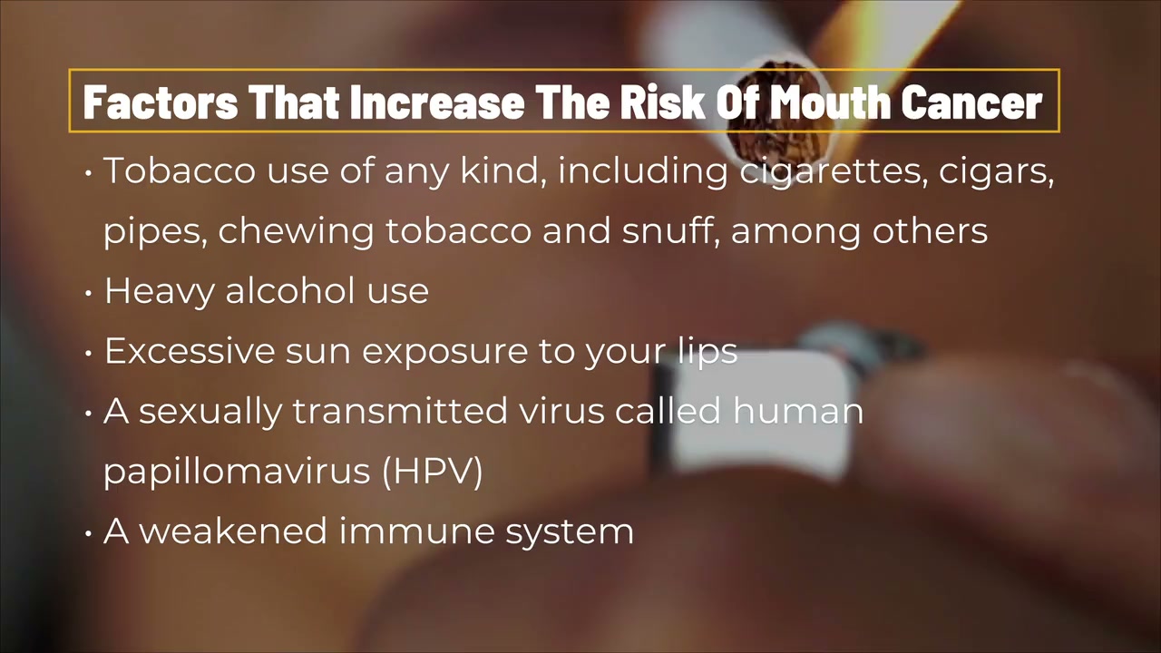 The signs & symptoms of mouth cancer