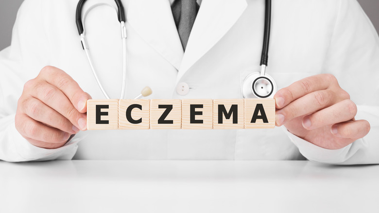 The different types of eczema