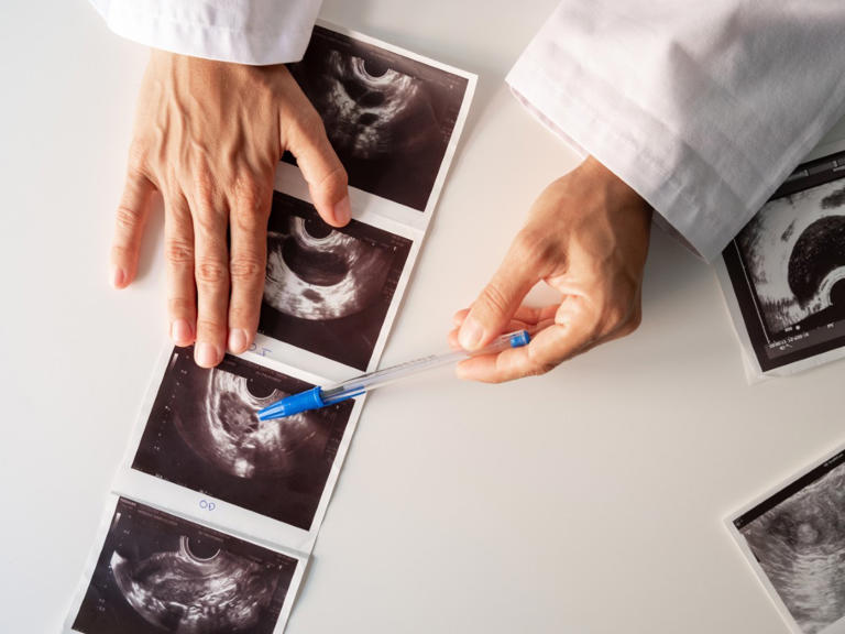 Condition affecting millions of women may be linked to dementia risk
