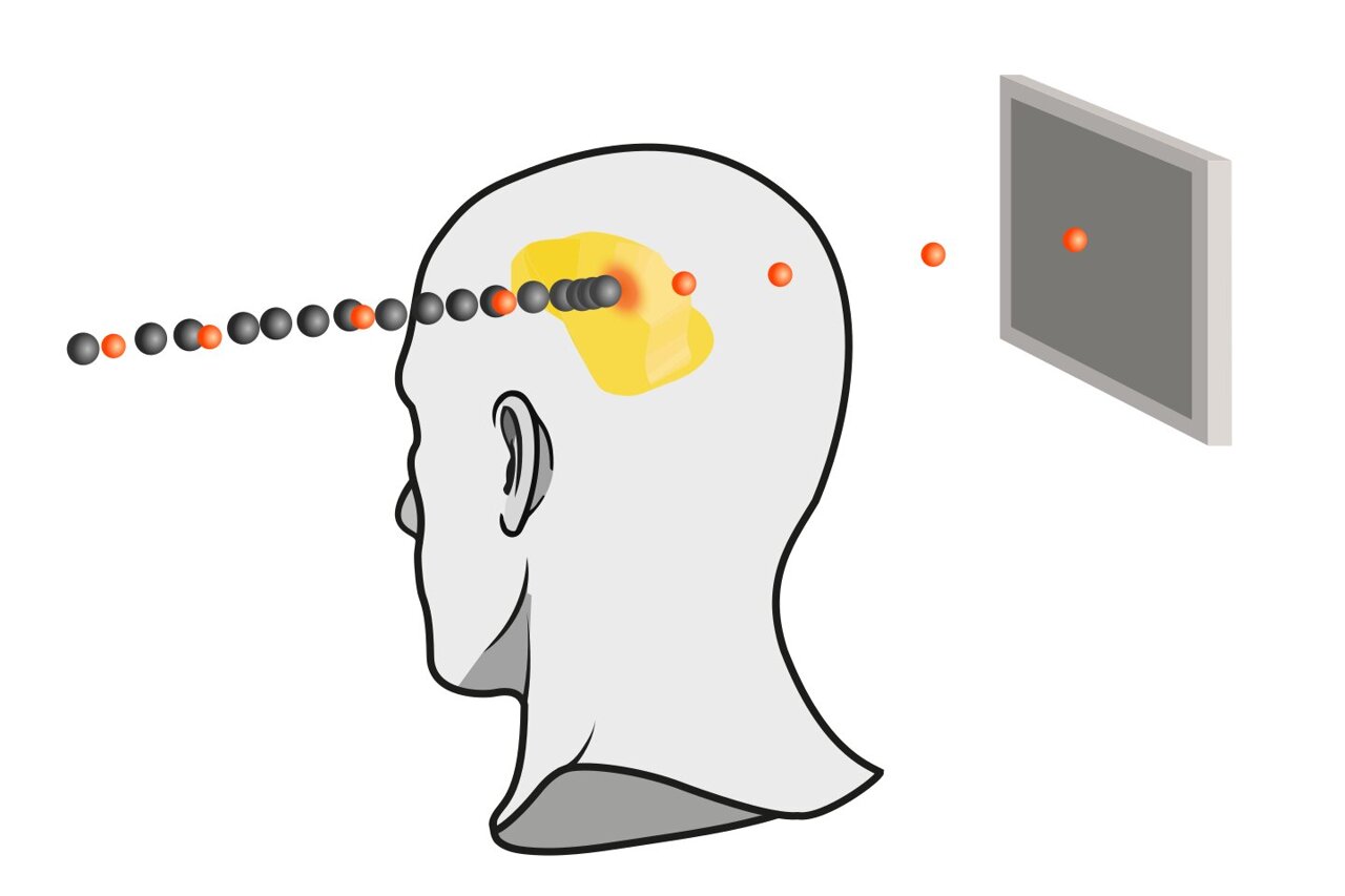 Mixed beam measurement method could help make ion cancer therapy more ...