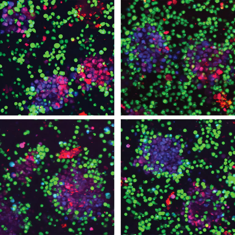 Cancer-promoting protein also helps engineered immune cells fight ...
