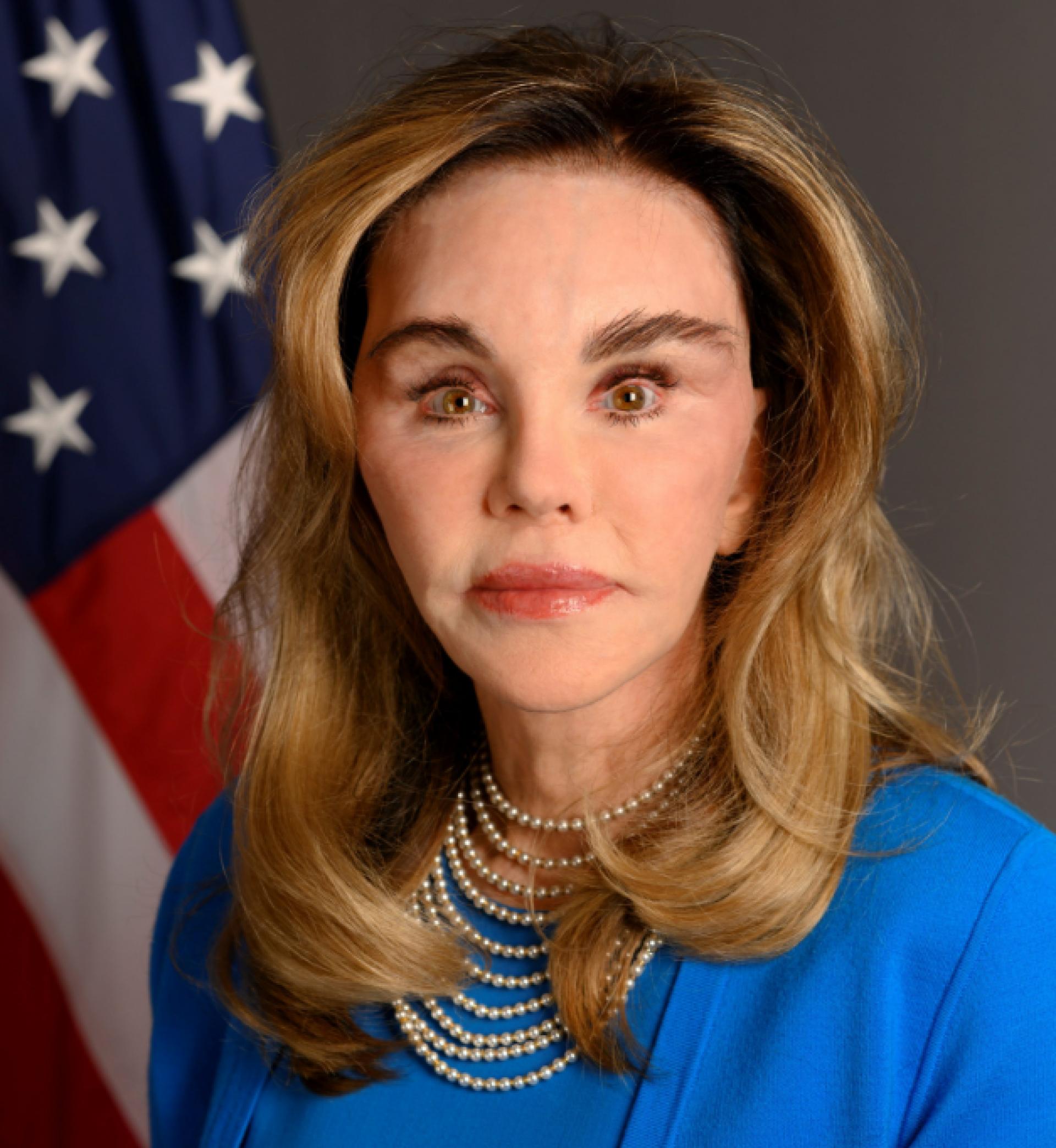 Photo of Trump's new ambassador goes viral: See what she looked like before