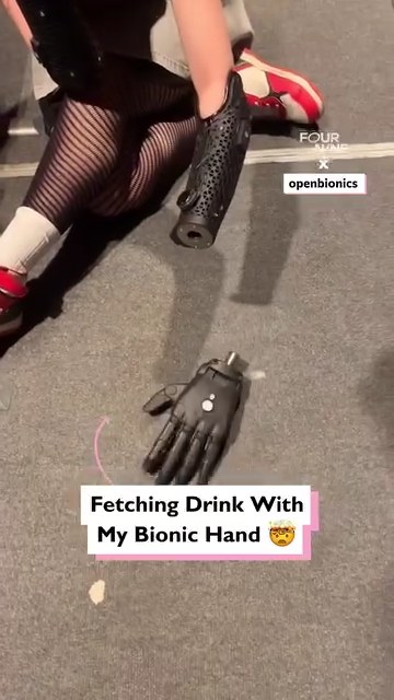 My bionic hand is blowing people's minds