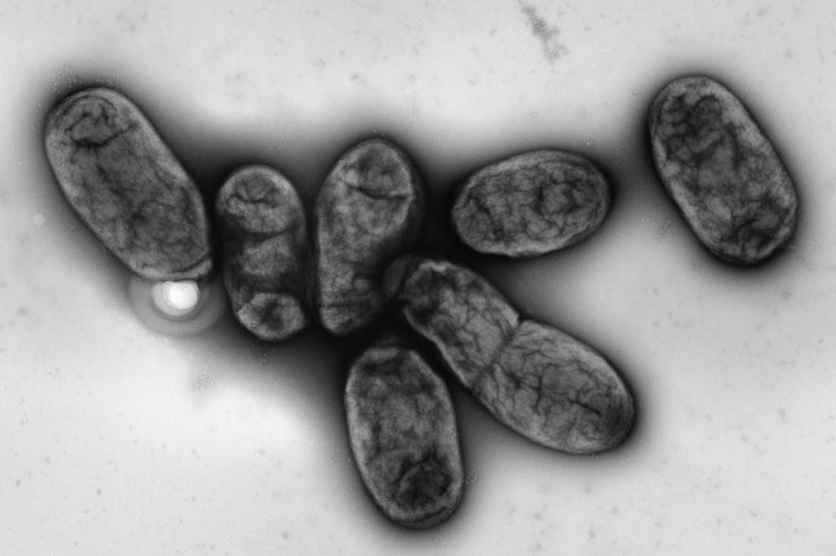 Angst und Fakten: Wie das Gesundheitsamt Karlsruhe die Pest-Gefahr ...