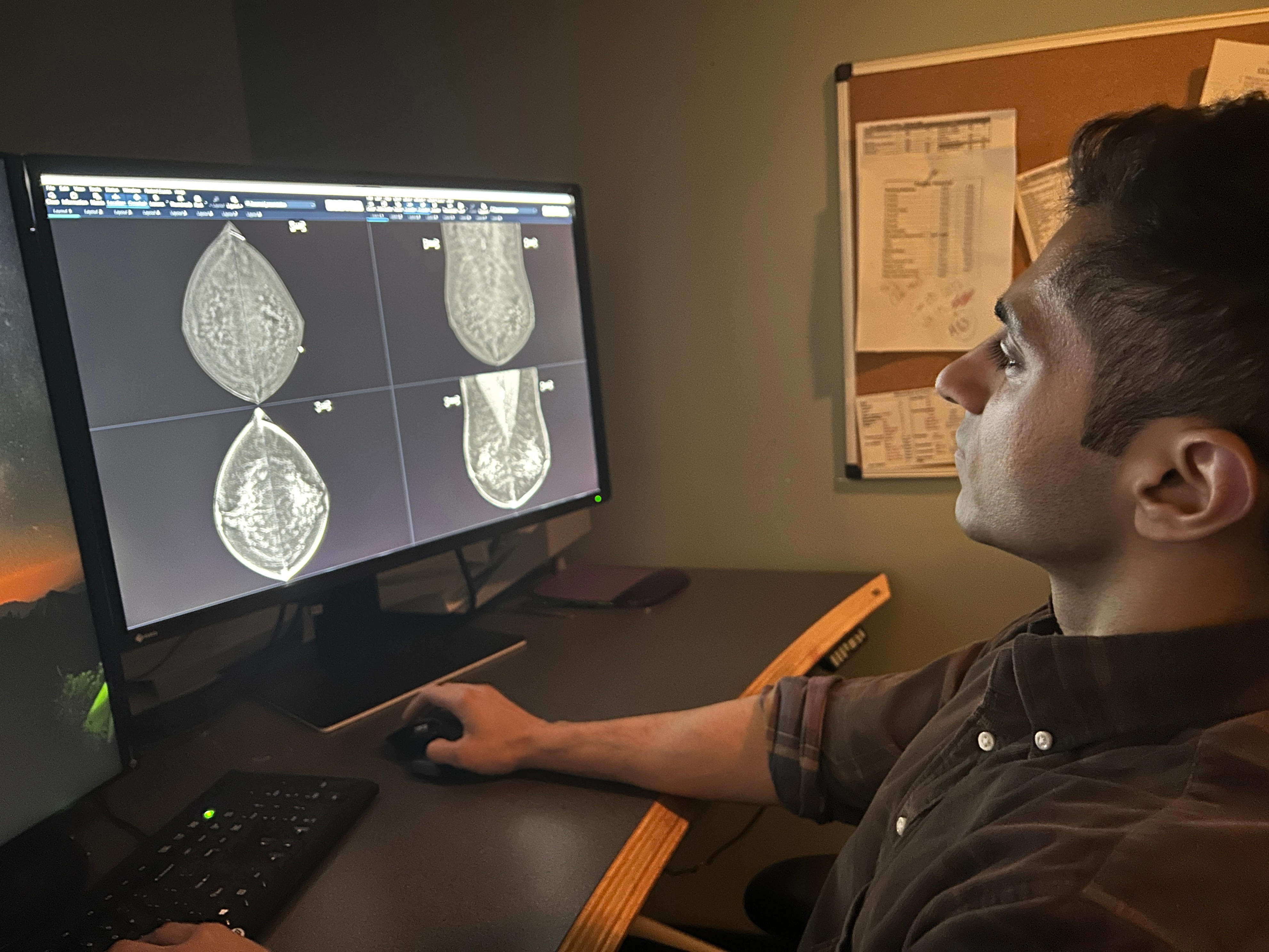 Why annual mammograms are still the gold standard | Exclusive