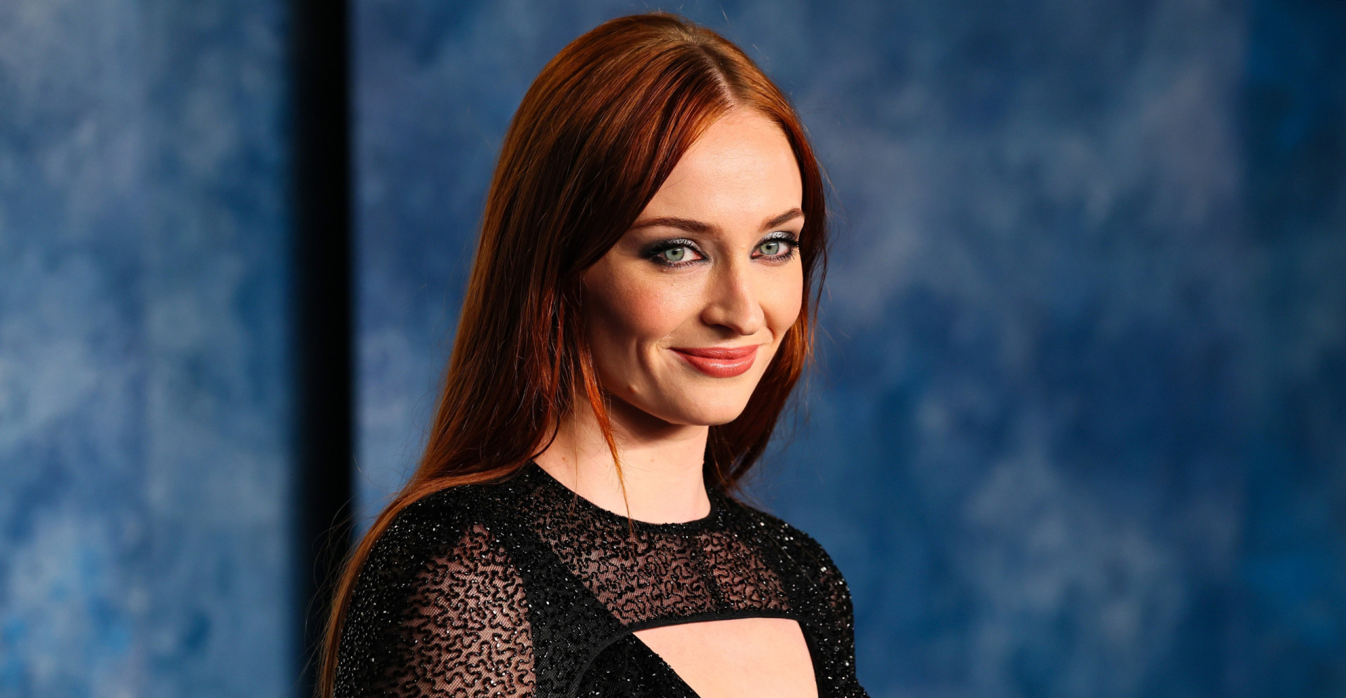 Scoliosis and the celebrities afflicted with this spinal deformity