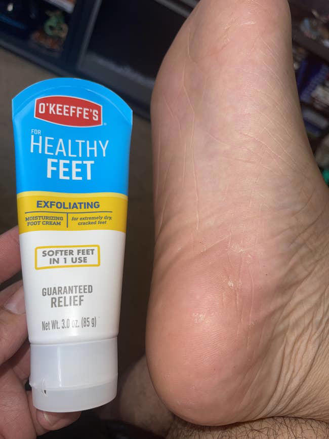 Just 16 products that'll help with calluses