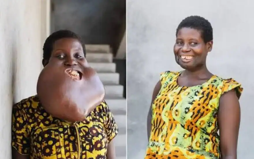 Mulher passa por transforma&ccedil;&atilde;o ap&oacute;s cirurgia