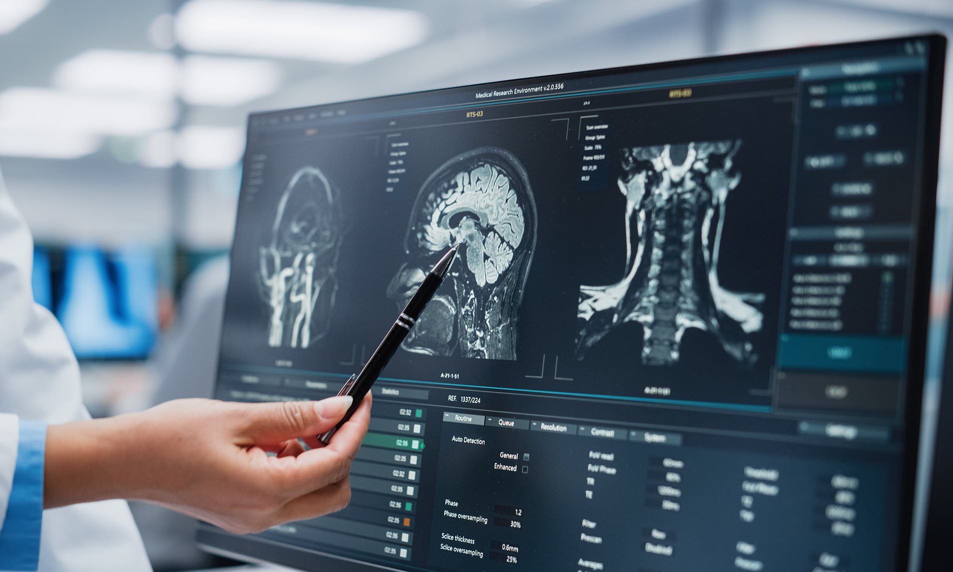 Experts raise alarm over concerning rise of deadly brain-liquefying fungus
