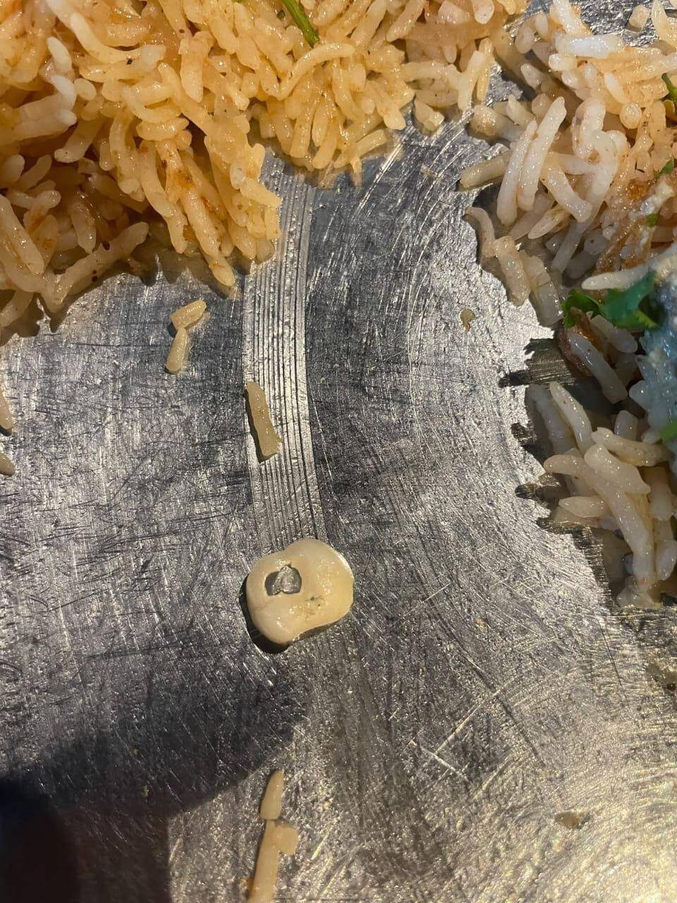 Diner finds human tooth in mutton mandi at Madhapur eatery
