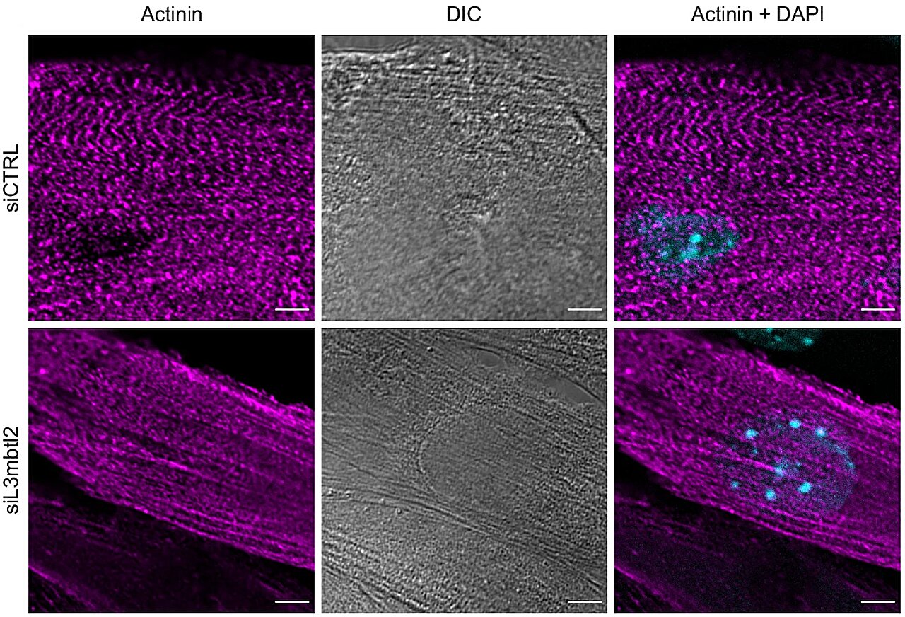 Protein modification partially reverses cancer-related muscle wasting ...
