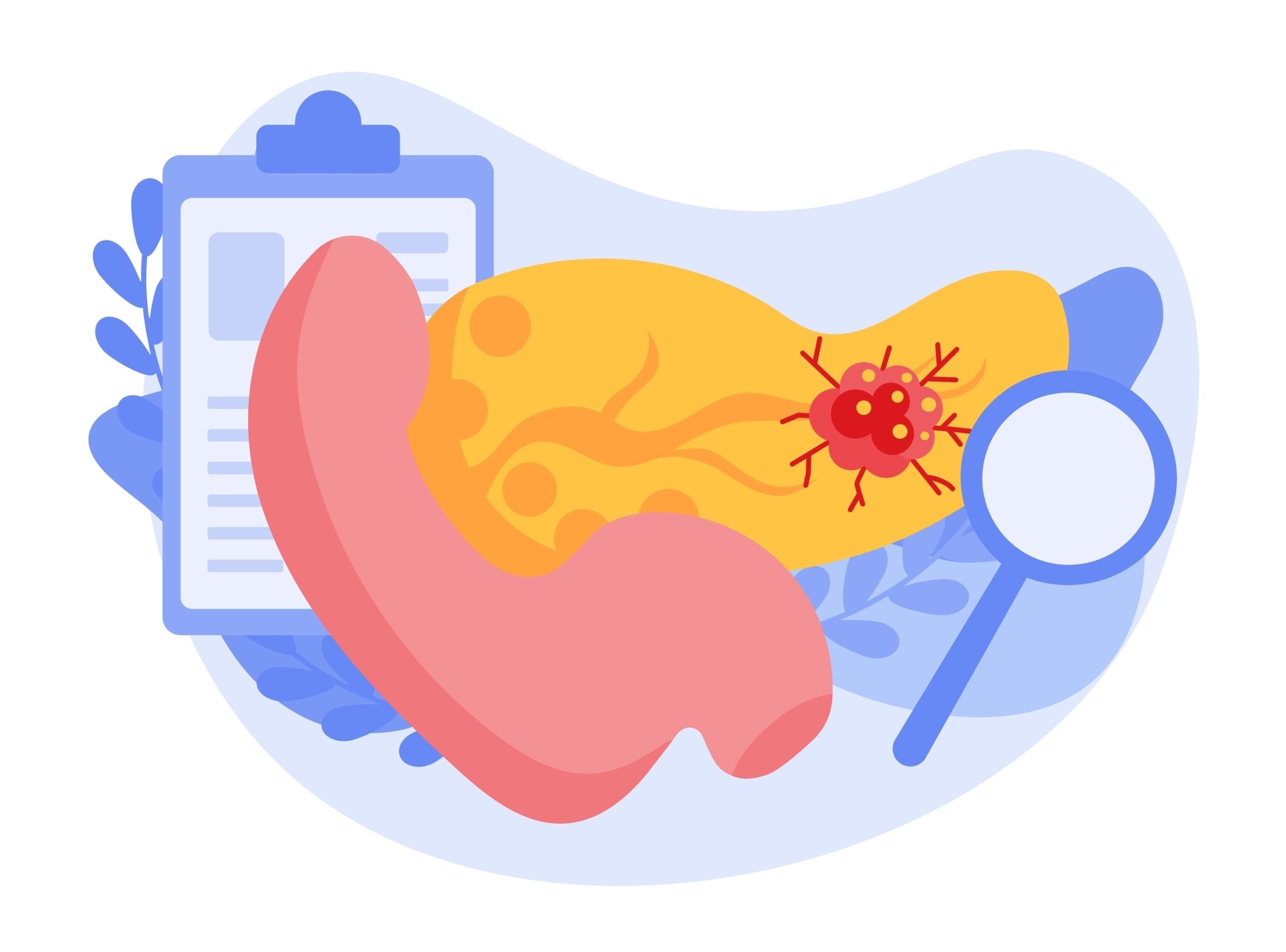 Verastem’s KRAS inhibitor posts wins in mPDAC, mCRC and NSCLC
